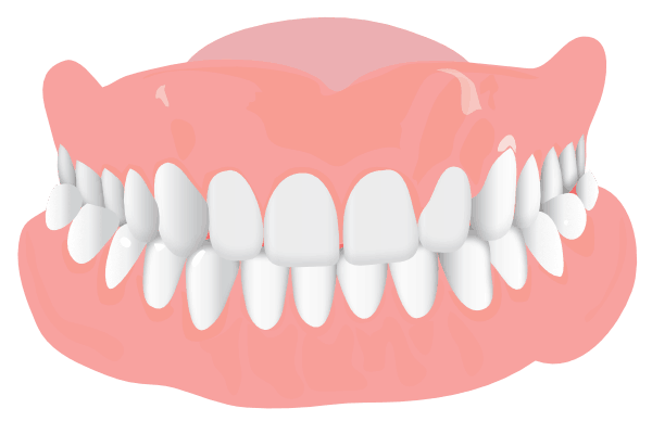 Orthodonist Treatment - Graphics of a teeth structure (Crossbite)