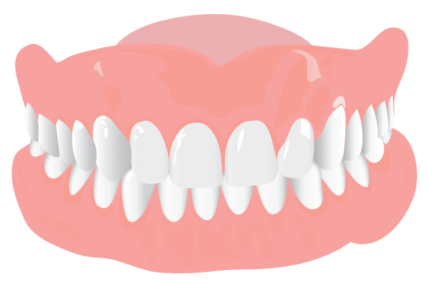 Orthodonist Treatment - Graphics of a teeth structure (Overbite)