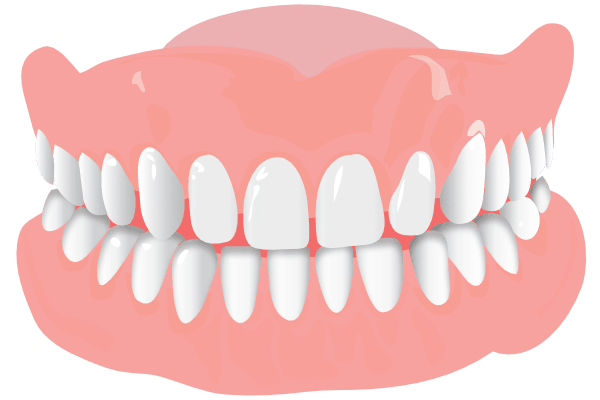 Orthodonist Treatment - Graphics of a teeth structure (Widely Spaced)