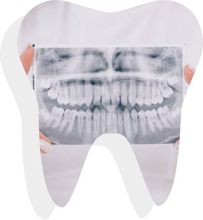 Dental X-Ray