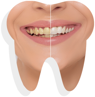 teeth-whitening-banner-sample-01