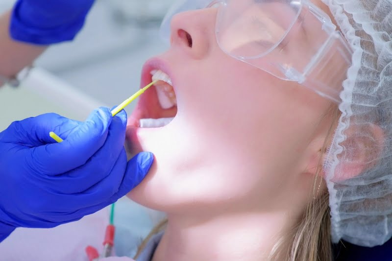 Kids Dentist Singapore - a dentist applying concentrated fluoride on the teen's teeth after cleaning her teeth