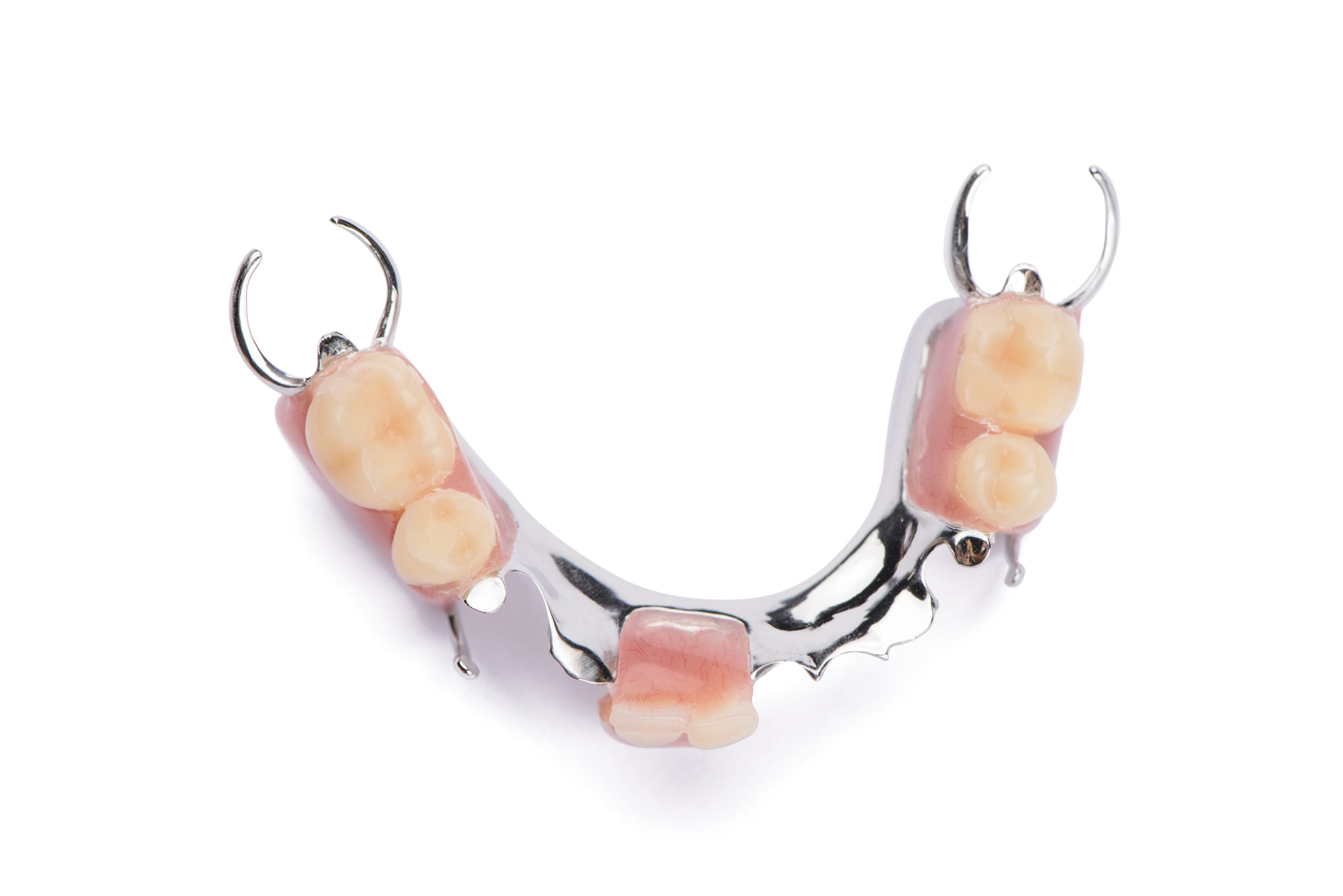 metal dentures