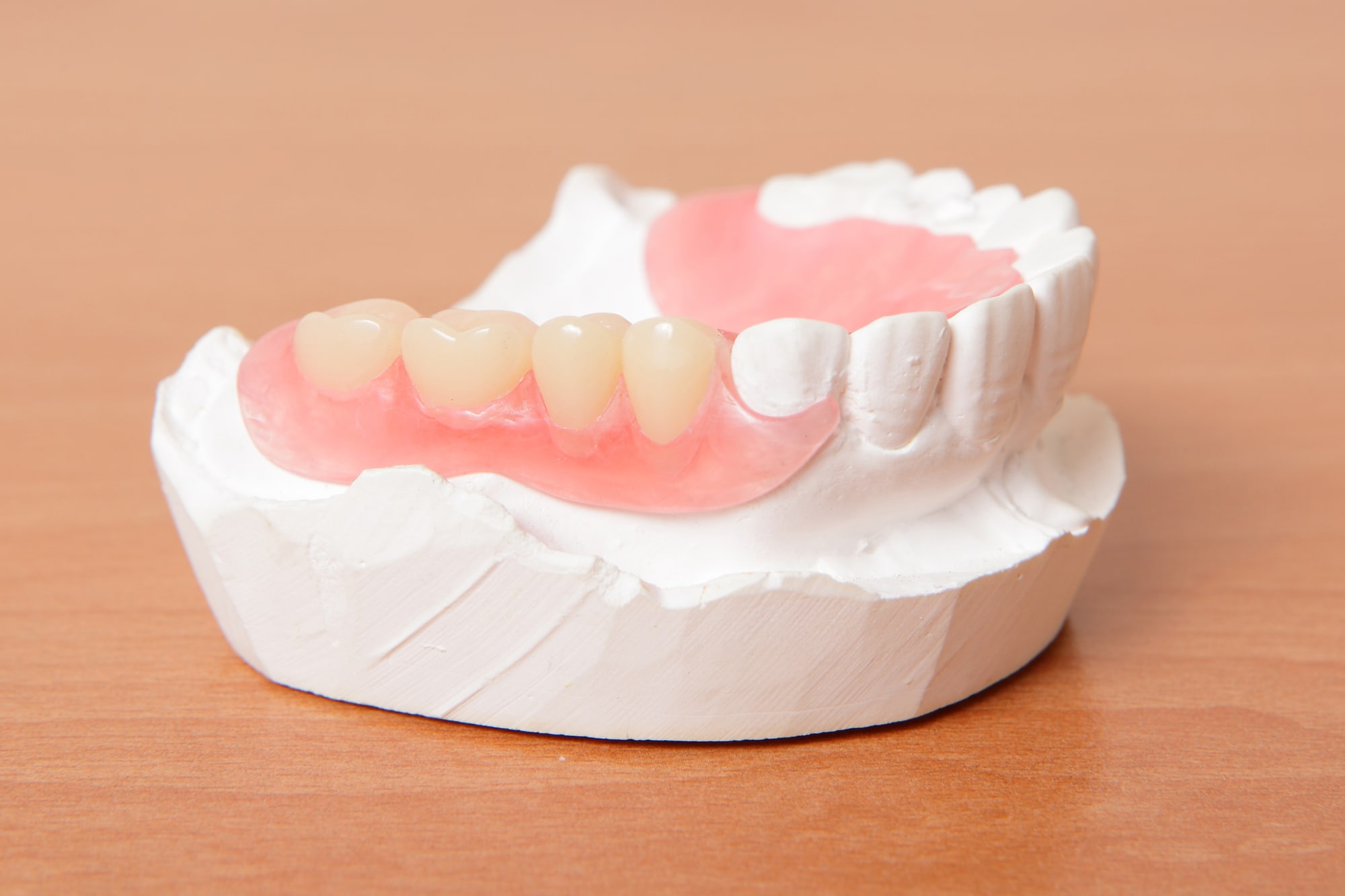 acrylic denture