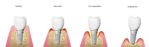 importance of bone in dentistry