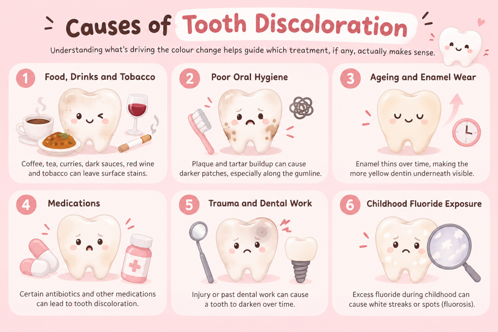infographic article about causes of tooth discoloration